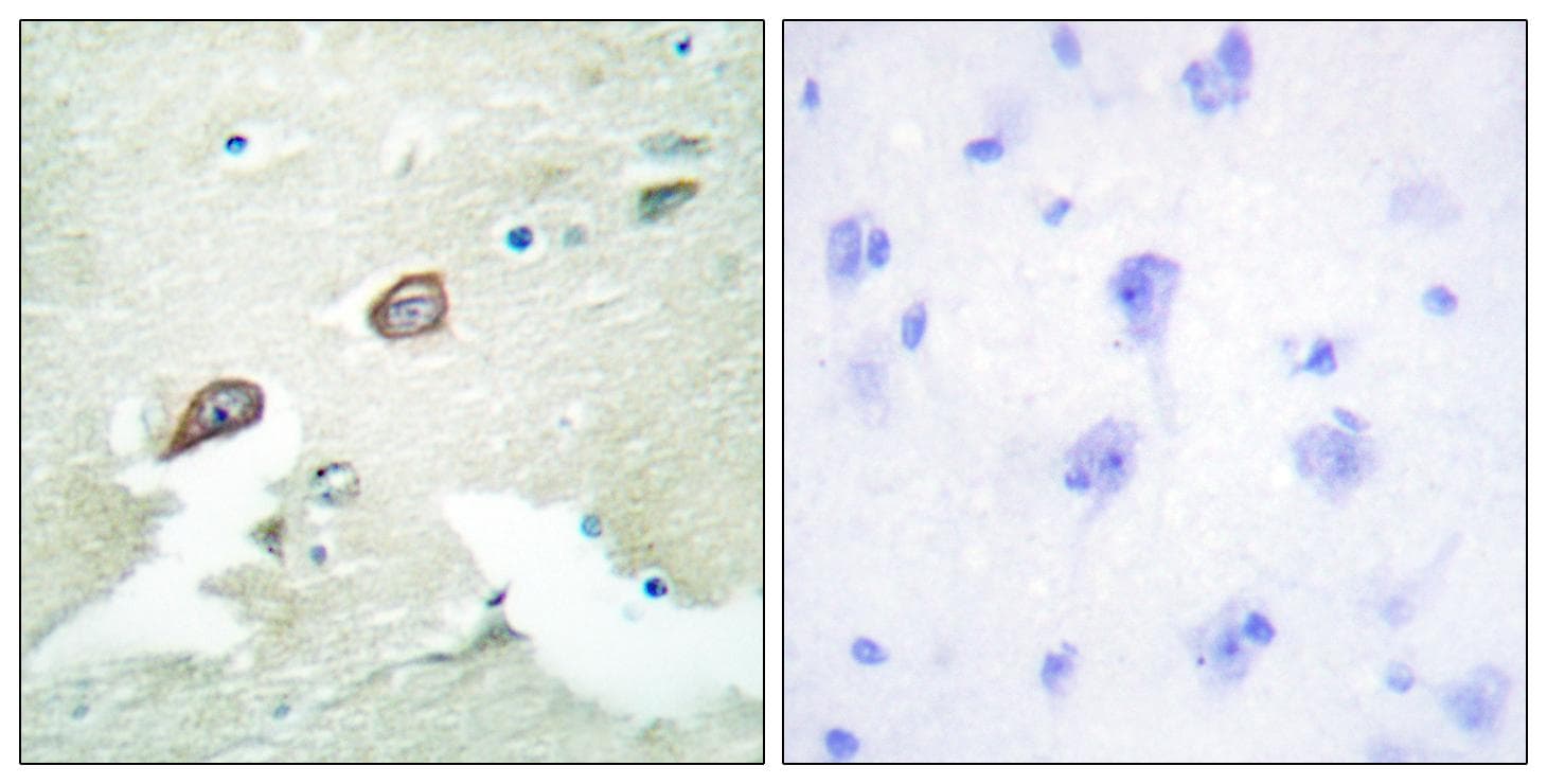 Polyclonal Rabbit anti-Human ERBB3 / HER3 Antibody (p1222, IHC, IF, WB)
