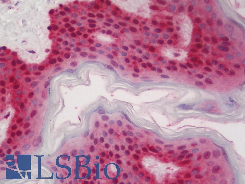 IHC-plus™ RCAN1 / DSCR1 Antibody (aa190-239)
