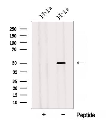 Polyclonal Rabbit anti-Human ADIPOR2 Antibody (WB)