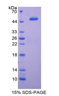 Human IFNA2 / Interferon Alpha 2 Protein (Recombinant His-GST)