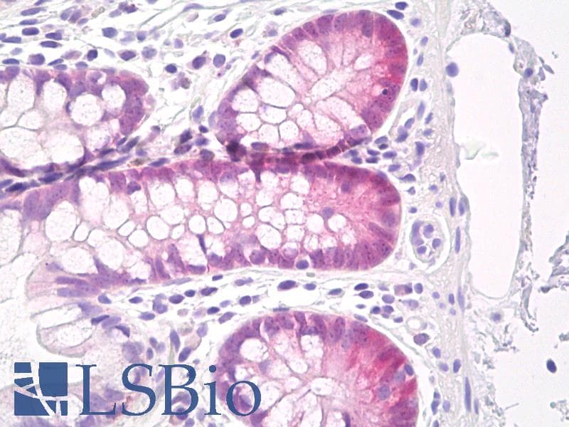 IHC-plus™ GPX2 Antibody