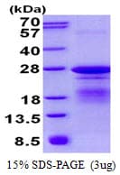 Human TREM1 Protein (Recombinant His)