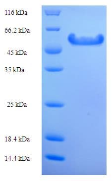 Ambrosia artemisiifolia PLY5 / Pectate Lyase 5 Protein (Recombinant His-SUMO)