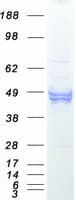 Human CD14 Protein (Recombinant Myc-DDK (Flag))