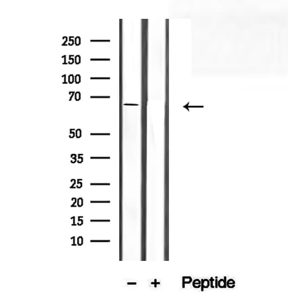 Polyclonal Rabbit anti-Human SEC24A Antibody (IHC, IF, WB)