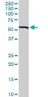Monoclonal Mouse anti-Human BAG5 Antibody (clone 1E3, WB)