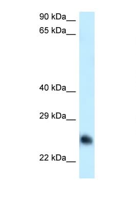 CABYR Antibody (aa93-142)