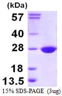 Human EMC8 / COX4NB Protein (Recombinant His)