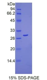 Human PRDX3 / Peroxiredoxin 3 Protein (Recombinant His)