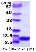 Mouse S100A6 / Calcyclin Protein (Recombinant His)