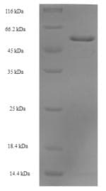 Human SEPT2 / Septin 2 Protein (Recombinant 6His-SUMO, N-terminus)