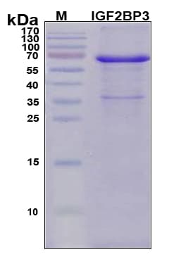 Human IMP-3 / IGF2BP3 Protein (Recombinant 6His, N-terminus)