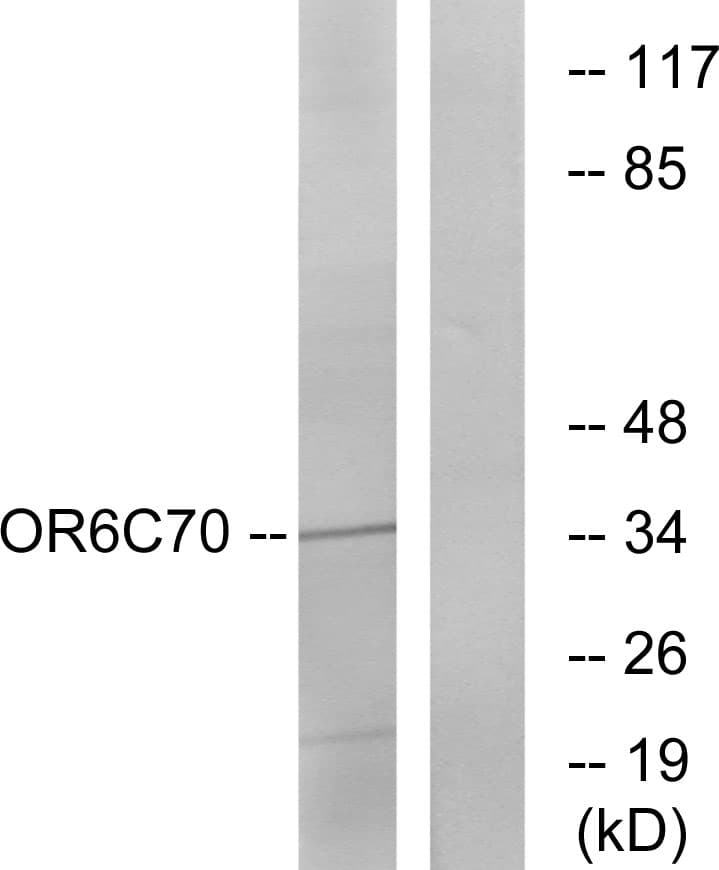 OR6C70 Antibody (aa231-280)