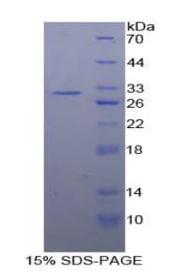Human STAT2 Protein (Recombinant His-T7)