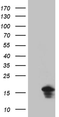 EIF4E3 Antibody (clone OTI2B9)