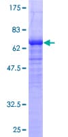 Human NDRG2 Protein (Recombinant GST)