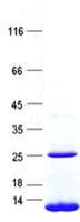 Human Neuropeptide Y / NPY Protein (Recombinant His, N-Terminal)