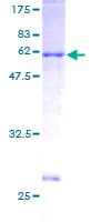Human LAT Protein (Recombinant GST)