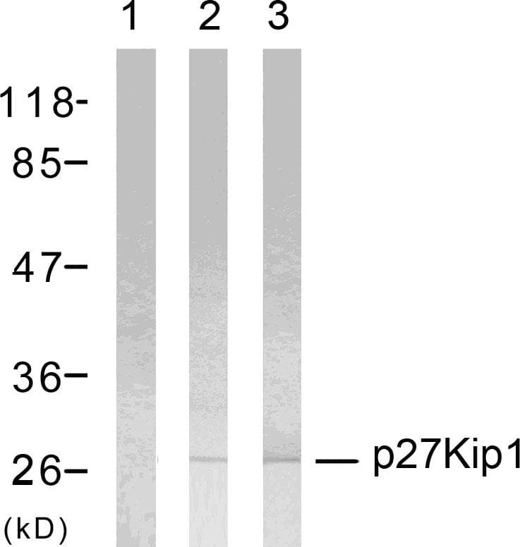 Polyclonal Rabbit anti-Human CDKN1B / p27 Kip1 Antibody (phospho-Thr187, WB)