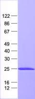 Human RPL17 / Ribosomal Protein L17 (Recombinant His, N-Terminal)