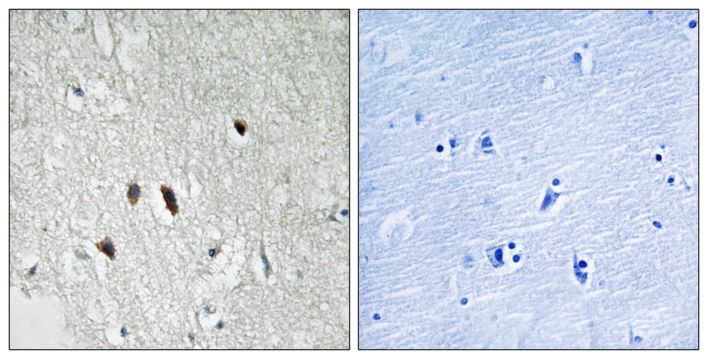 RICK / RIP2 Antibody (aa146-195)