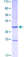 Human CYP1B1 Protein (Recombinant GST, N-terminus)