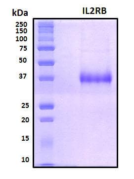 Human IL2RB / CD122 Protein (Recombinant His, N-Terminal)