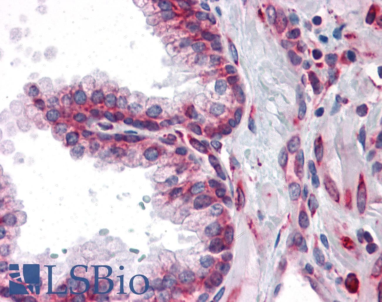 IHC-plus™ Monoclonal Mouse anti-Human MTDH / Metadherin Antibody (clone 2F11C3, IHC, WB)