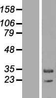 MAPK1IP1L Protein (Over-Expression Lysate Myc-DDK (Flag))