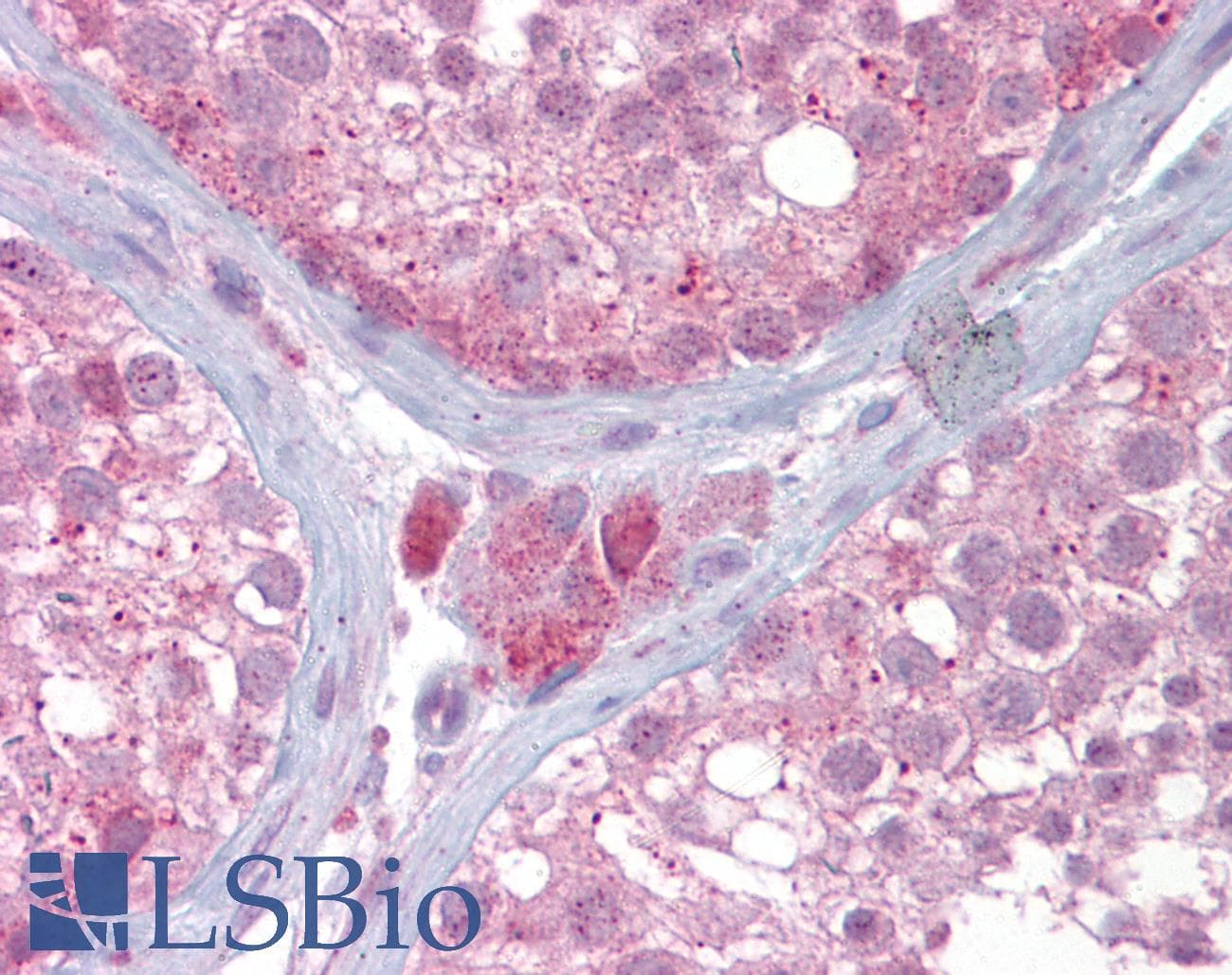UBE2L3 / UBCH7 Antibody (aa35-84)