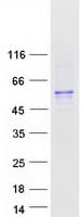 Human SMAD9 Protein (Recombinant Myc-DDK (Flag))