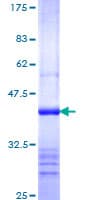 Human Nucleocapsid Protein (Recombinant GST, N-terminus)