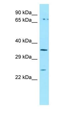 Polyclonal Rabbit anti-Human ORAI3 Antibody (C-Terminus, WB)