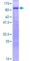 Human JUP/CTNNG/Junction Plakoglobin Protein (Recombinant GST)