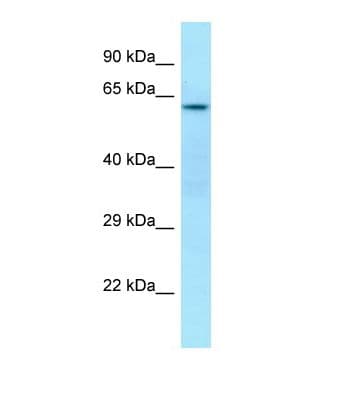 CDK5RAP3 Antibody (aa267-316)