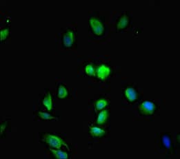 Polyclonal Rabbit anti-Human MED20 Antibody (IHC, IF)