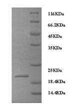 Dog IL8 / Interleukin 8 Protein (Recombinant 6His, N-terminus)