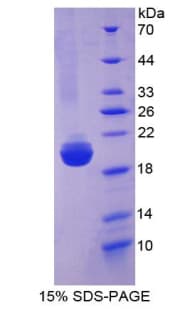 Human SLIT2 Protein (Recombinant His, N-Terminal)