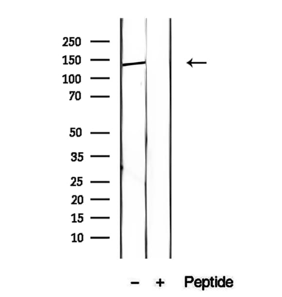 Polyclonal Rabbit anti-Human HPS5 Antibody (IHC, WB)