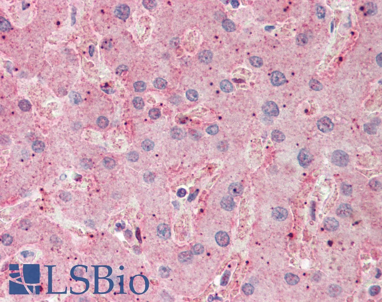 ASGR2 Antibody (aa71-120)