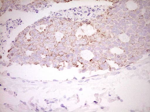 FOS / c-FOS Antibody (clone OTI7D6)