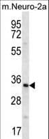 PEX14 Antibody (aa121-150)