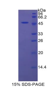 Pig Alpha-Fetoprotein (Recombinant His-GST)