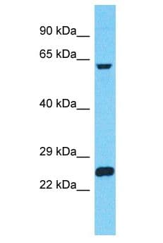 Polyclonal Rabbit anti-Human ZNF737 Antibody (aa95-144, WB)