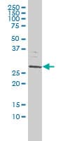 Monoclonal Mouse anti-Human SMNDC1 Antibody (clone 2B9, IHC, WB)