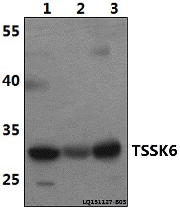 Polyclonal Rabbit anti-Human TSSK6 Antibody (WB)