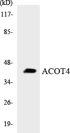 ACOT4 Antibody (aa351-400)