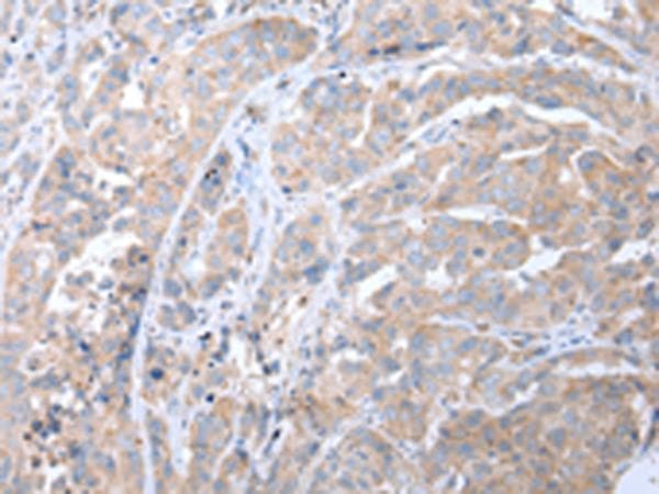 Polyclonal Rabbit anti-Human ATG16L1 / ATG16L Antibody (IHC, WB)