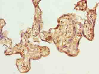 Polyclonal Rabbit anti-Human GPSM3 Antibody (IHC)