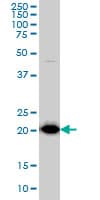 TPT1 / TCTP Antibody (clone 3C7)